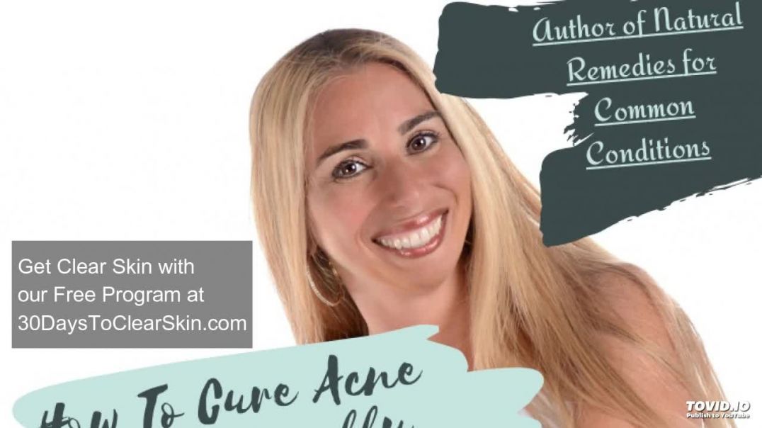 How To Cure Acne Naturally That Actually Work! [10 Top Tips]