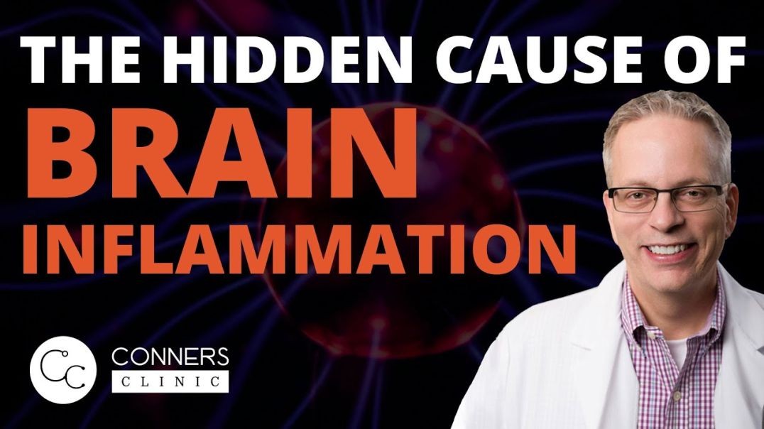 The Hidden Cause of Brain Inflammation Your Doctor Always Misses | Dr. Kevin Conners, Conners Clinic