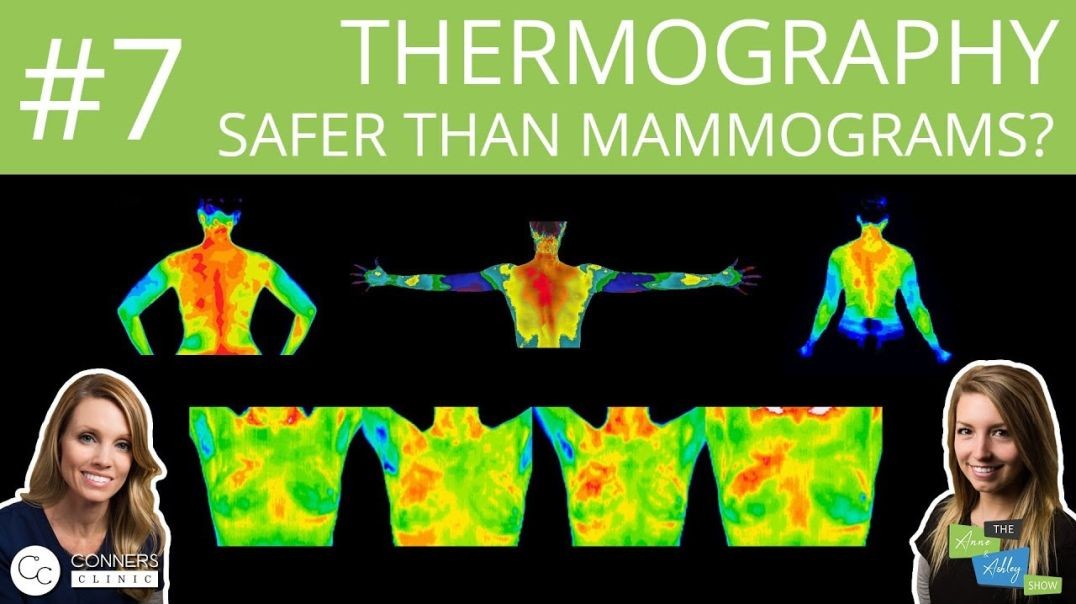 #7: Thermography: Safer Than Mammograms? | The Anne & Ashley Show