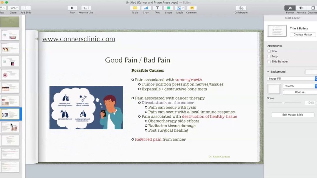 Dr. Kevin Conners | Conners Clinic - Cancer - Good Pain / Bad Pain