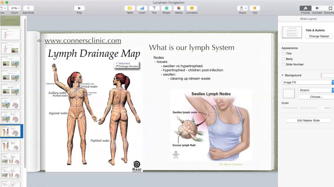 Dr. Kevin Conners | Conners Clinic - Lymph Congestion helps