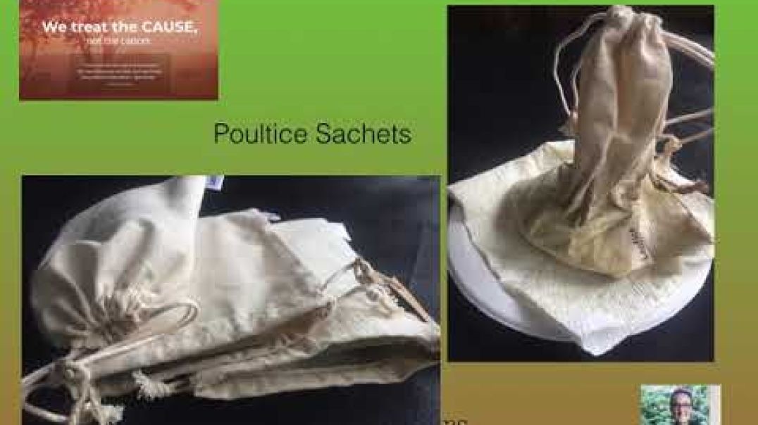 Dr. Kevin Conners - Member's Minute 7 - Cancer Poultice Sachets