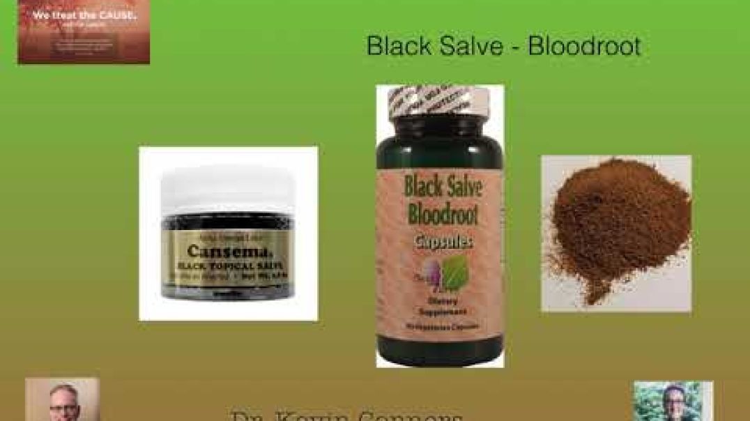 Dr. Kevin Conners - Member's Minute 12 - Black Salve/Bloodroot