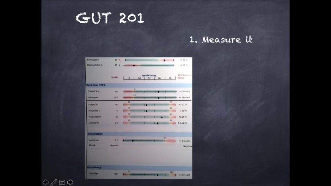 Gut 201 with Jason Rozin - Dr. Kevin Conners