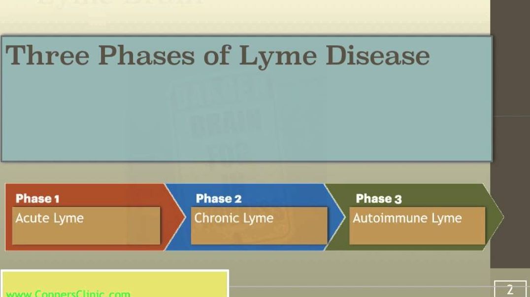 Lyme Brain Book by Dr. Kevin Conners of Conners Clinic | Chronic Lyme Disease