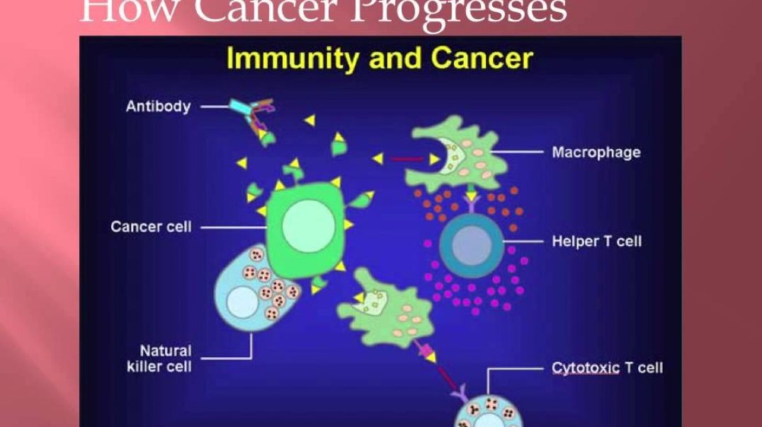 Cancer Class 2 DIET - Dr. Kevin Conners