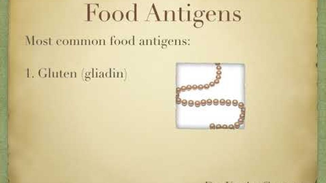 Dr. Kevin Conners - Cancer and Food Antigens