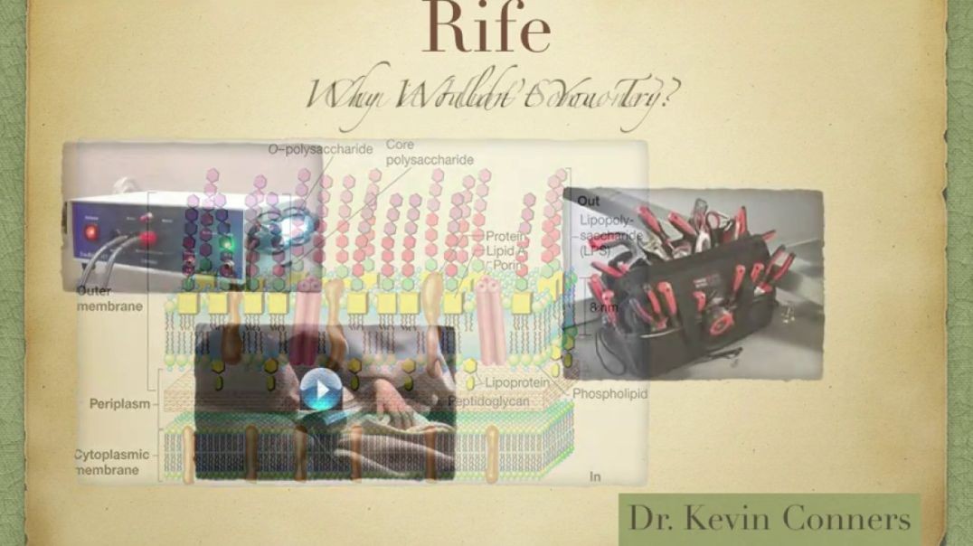 Rife Q & A - Dr. Kevin Conners