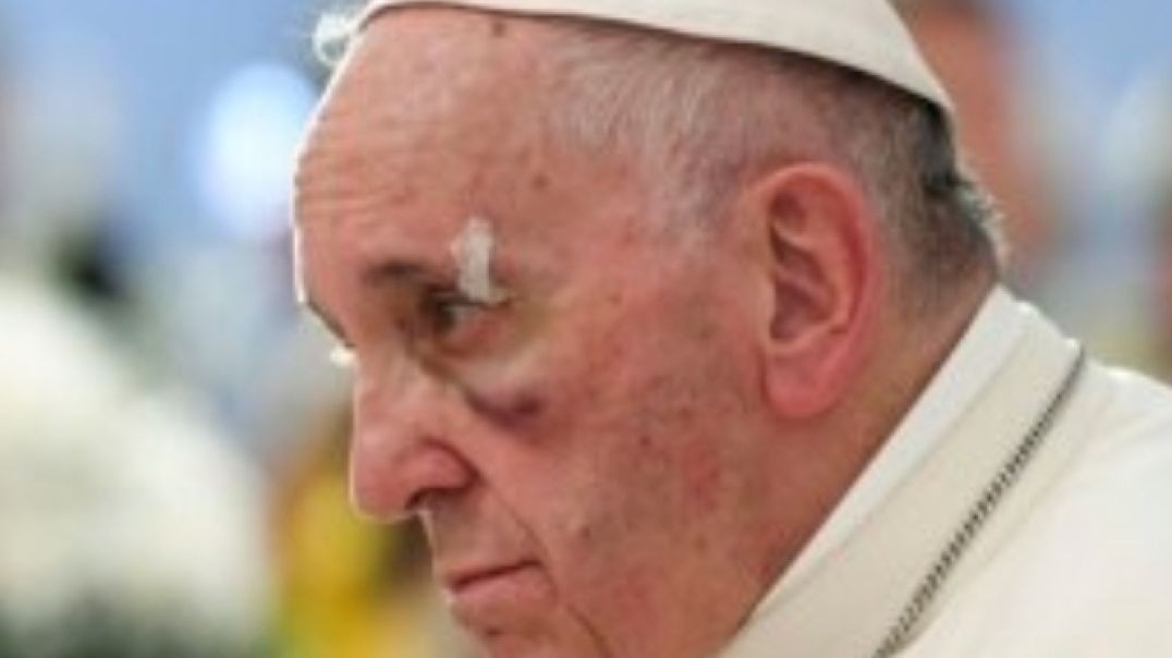 What Happened to the Pope?