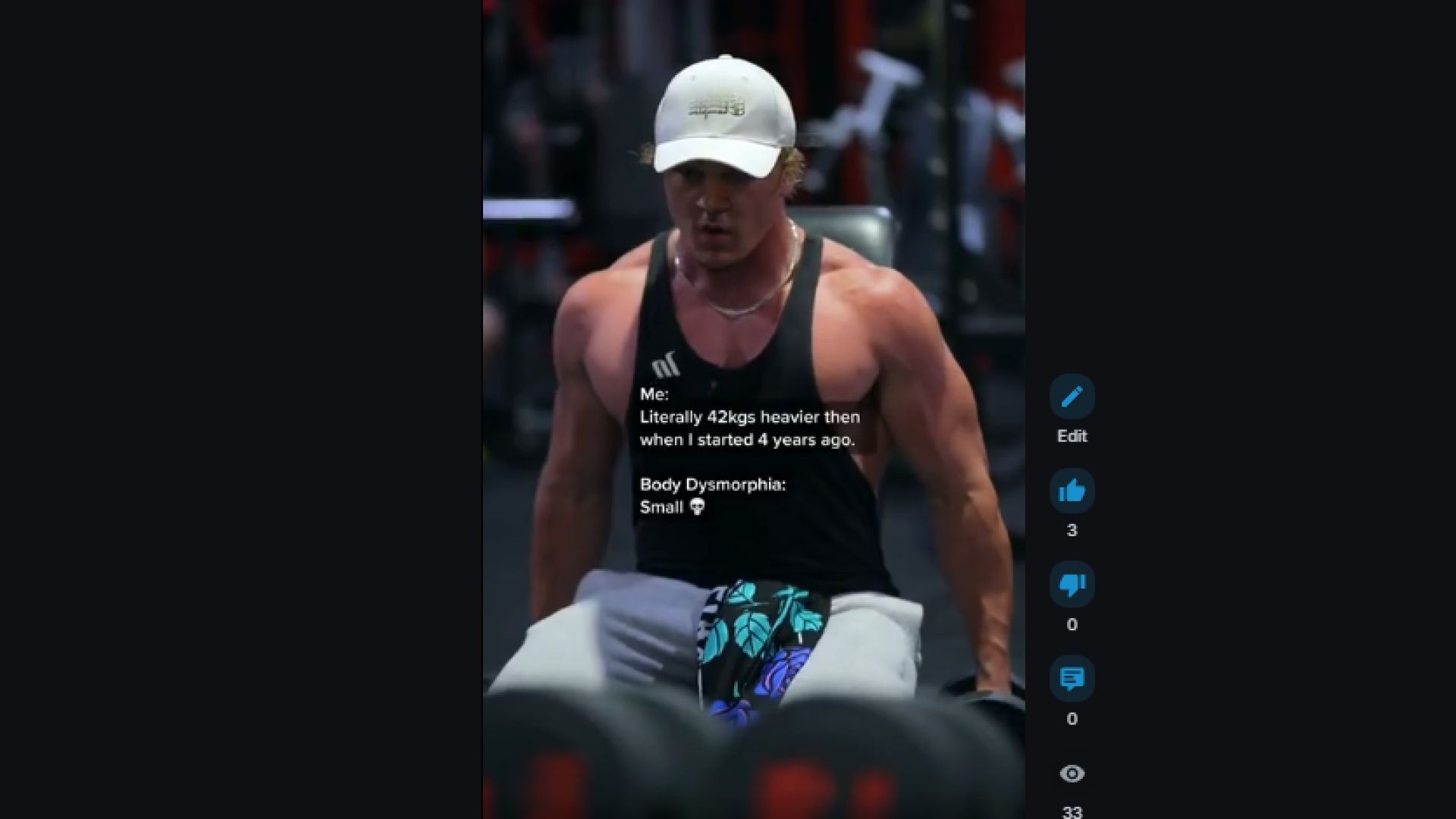 Body Dysmorphia
